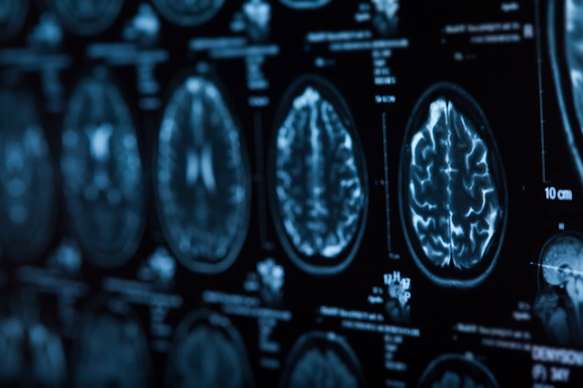 Neurologie